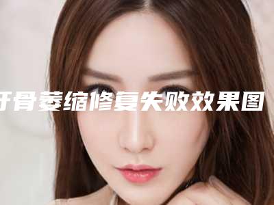 牙骨萎缩修复失败效果图(牙骨萎缩修复整形手术的效果真的是永久)