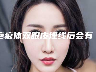 疤痕体双眼皮埋线后会有什么不良的影响吗