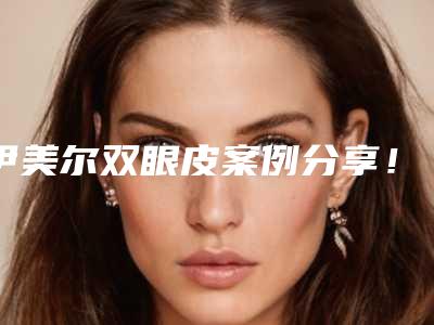 伊美尔双眼皮案例分享!80天的效果姐妹们康康怎么样!