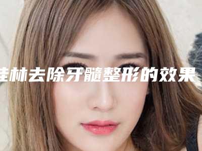 桂林去除牙髓整形的效果自然不