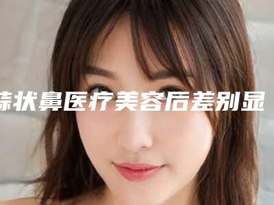 蒜状鼻医疗美容后差别显目吗
