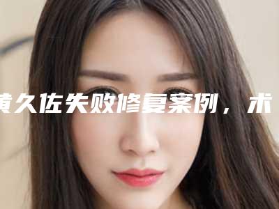 黄久佐失败修复案例,术后效果让我变成小美女
